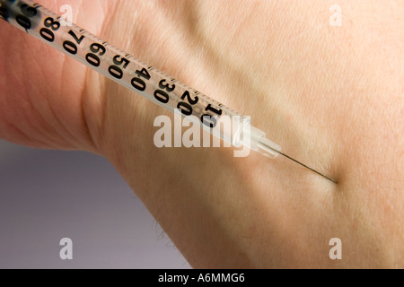 Hypodermic Syringe needle entering vein in arm Stock Photo: 6666795 - Alamy