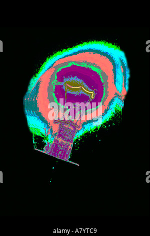 Conceptual image of incandescent light bulb exploding in the dark Stock Photo