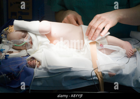 surgeon preparing two month old baby patient for heart surgery in operating room Stock Photo