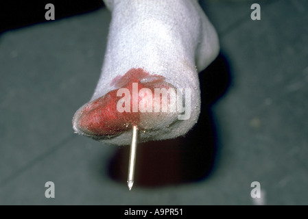 105 Big Toe Bleeding Royalty-Free Images, Stock Photos & Pictures |  Shutterstock