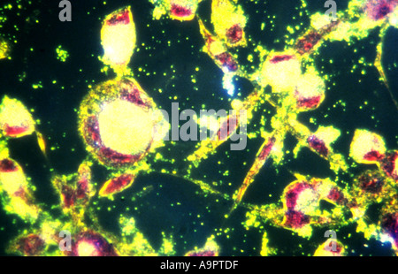 Photomicrograph Chlamydia trachomatis Stock Photo