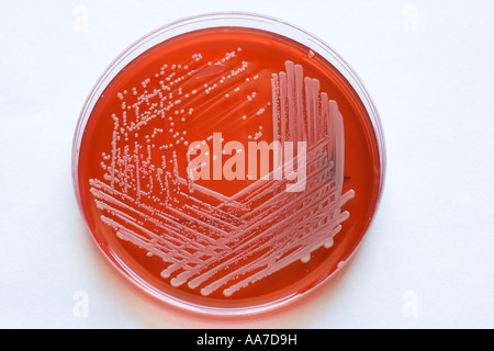 blood agar plate growing MRSA bacteria Stock Photo - Alamy