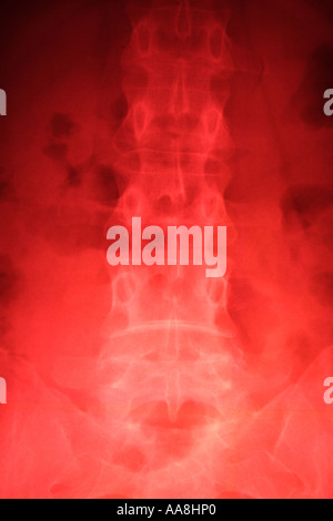 XRAY OF THE FEMALE ABDOMINAL REGION VERTICAL BAPDB7315 Stock Photo