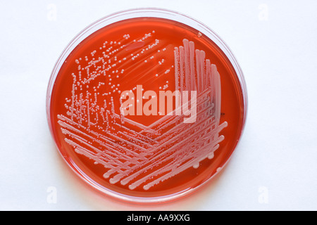 blood agar plate growing MRSA bacteria Stock Photo