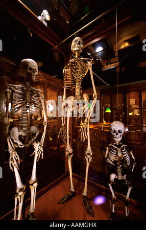 Mütter Museum of The College of Physicians of Philadelphia - The photograph  from earlier, shown again on the left, is the skeleton of a woman who wore  a corset that caused deformation