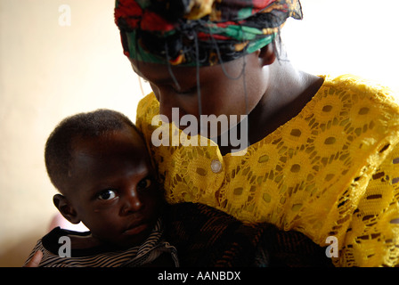 A woman holds a malnourished child in a medical center. North Kivu, Congo DR central Africa