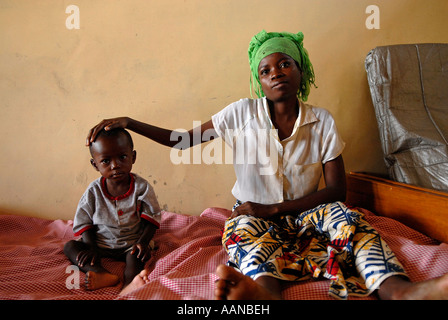 A malnourished child looks dejected at a UNICEF supported nutrition centre in North Kivu province, DR Congo Africa Stock Photo