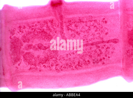 Dog tapeworm Taenia pisiformis segment stained Stock Photo