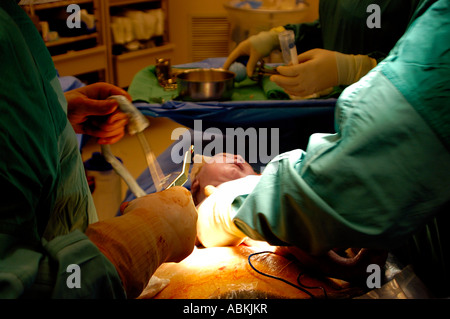 Birth of baby boy by caesarian section Stock Photo