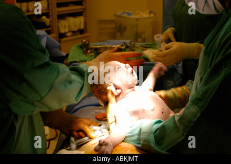 Birth of baby boy by caesarian section Stock Photo