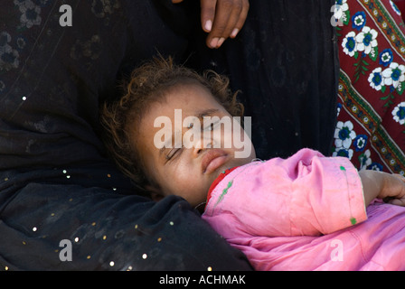 Conjunctivitis is often rife among children in African villages where the infection is passed on by flies Stock Photo