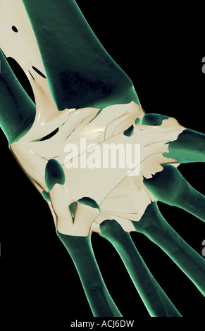 The ligaments of the wrist Stock Photo