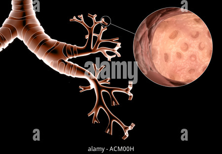 The bronchial tree and alveoli Stock Photo