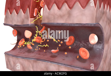 Blood clot formation Stock Photo