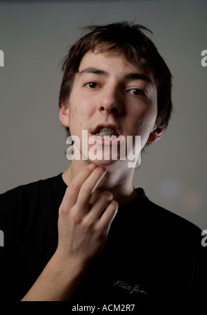 Teenage boy parting his lips to show off the fixed orthodontic braces on his teeth Stock Photo