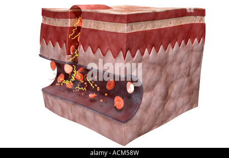 Blood clot formation Stock Photo