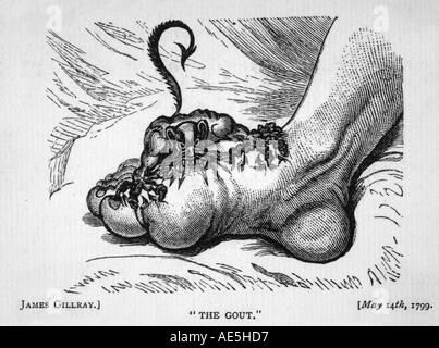 Gout Devil Bites 1799 Stock Photo