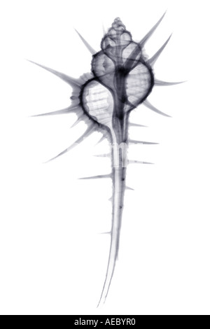 X-ray radiograph of a murex (Murex tribulus tenuirostrum).  Radiographie d un murex (Murex tribulus tenuirostrum). Stock Photo