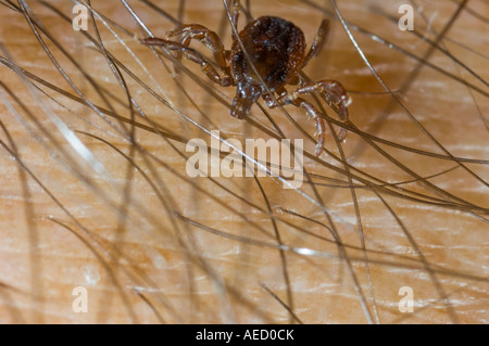 Tick (Hyalomma lusitanicum) on human arm, Spain Stock Photo