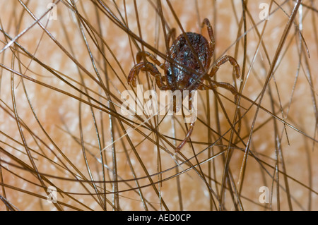 Tick (Hyalomma lusitanicum) on human arm, Spain Stock Photo