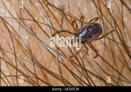 Tick (Hyalomma lusitanicum) on human arm, Spain Stock Photo