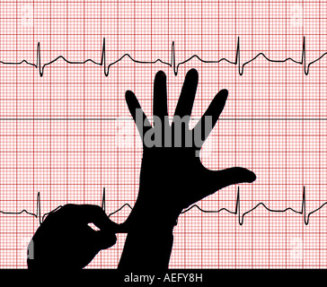 surgeon putting on surgical gloves composited on an EKG printout Stock Photo