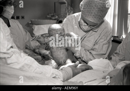 BABY BOY BEING DELIVERED BY CAESAREAN SECTION Stock Photo