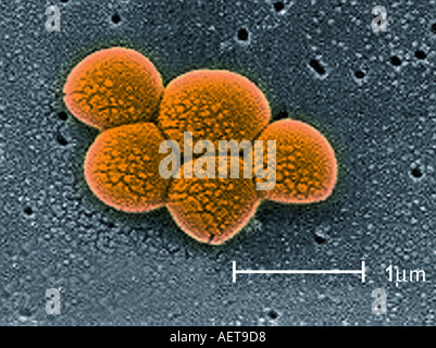 scanning electron microscope image of MRSA staphylococcus bacteria ...