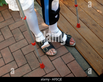 MR person man after operation with broken hurt leg Stock Photo