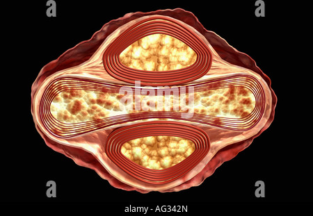 Smallpox virus Stock Photo