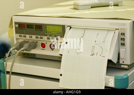 CTG, cardiotocograph and heart sound and contraction chart of an unborn ...