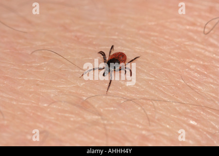 deer tick, black-legged tick (Ixodes scapularis, Ixodes dammini), female crawling on human skin, Germany, Bavaria, Staffelsee Stock Photo