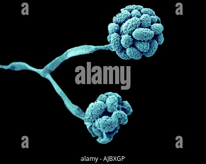 A scanning electron micrograph (SEM) of Stachybotrys chartarum Stock Photo