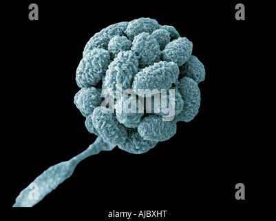 A scanning electron micrograph (SEM) of Stachybotrys chartarum Stock Photo