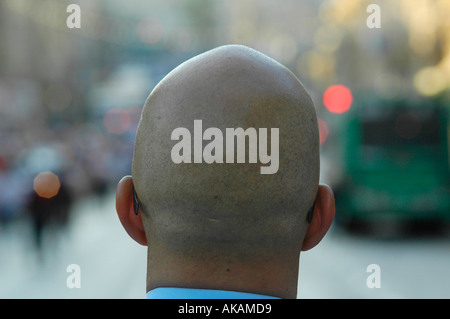 Bald man Stock Photo