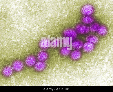 An electron micrograph West Nile virus. West Nile virus is flavivirus ...