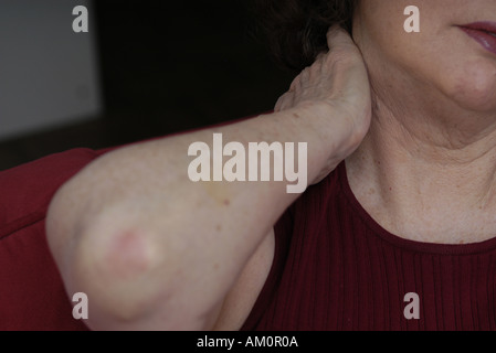 A woman messaging a sore spot on her body. Stock Photo