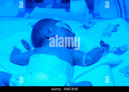 NewBorn premature  Baby in incubator - Neonatal Intensive Care Unit - NICU Stock Photo