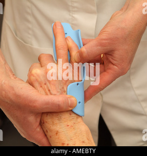 Dupuytrens Contracture Clinical Night Splint Fitting to Fingers and Hand Stock Photo