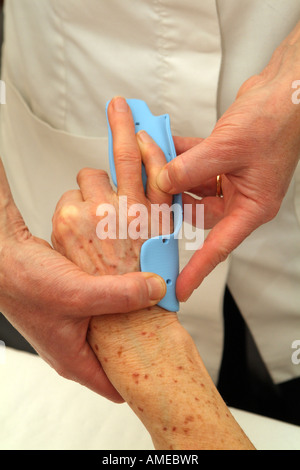 Dupuytrens Contracture Clinical Night Splint Fitting to Fingers and Hand Stock Photo