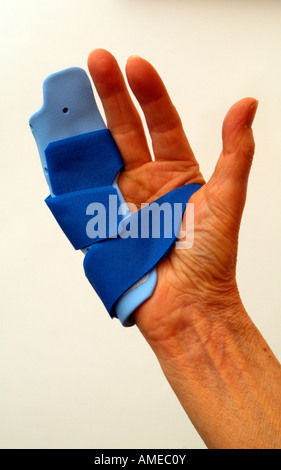 Dupuytrens Contracture Clinical Night Splint Fitting to Fingers and Hand Stock Photo