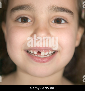 A girl missing a tooth Stock Photo