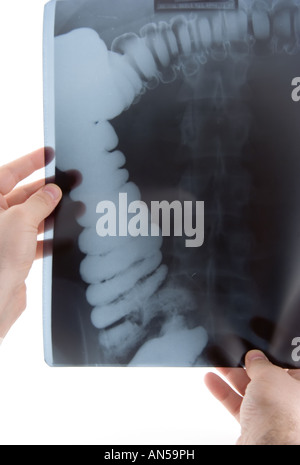 A doctor examining an abdominal x ray Stock Photo