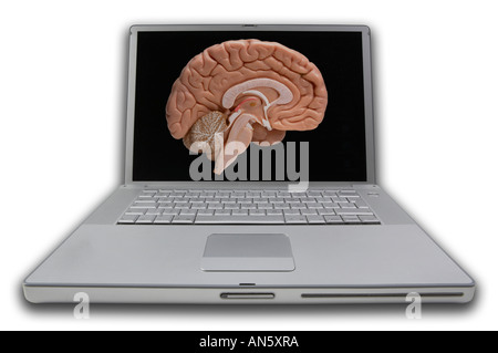 LAP TOP PORTABLE COMPUTER WITH SCREEN DISPLAYING PICTURE OF SLICE THROUGH HUMAN BRAIN Stock Photo