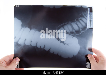 A doctor examining an abdominal x ray Stock Photo