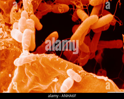 Color enhanced scanning electron micrograph of Agrobacterium tumefaciens which causes crown gall disease in a wide range of plan Stock Photo
