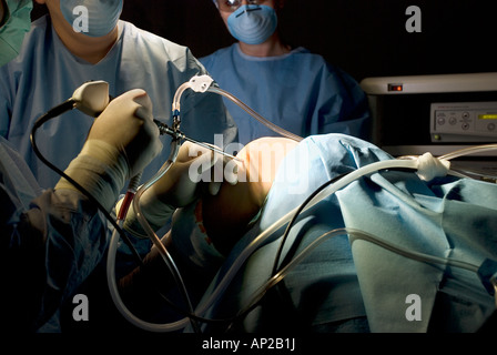 Surgical team performing arthroscopic knee surgery in hospital operating room Stock Photo