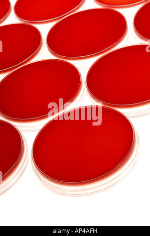 Blood agar culture media with Petri dishes