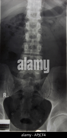 mri vs xray mri vs xray