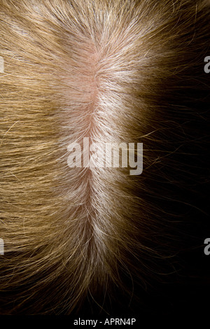 Grey roots ^showing through on a woman's hair Stock Photo